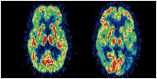 fMRI 뇌 사용부위.JPG